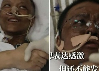 VIDEO. Wuhan. Altă anomalie, altă minciună a Chinei. Doi medici grav bolnavi s-au înnegrit în timpul tratamentului contra noului coronavirus. Cum explică asta comuniștii