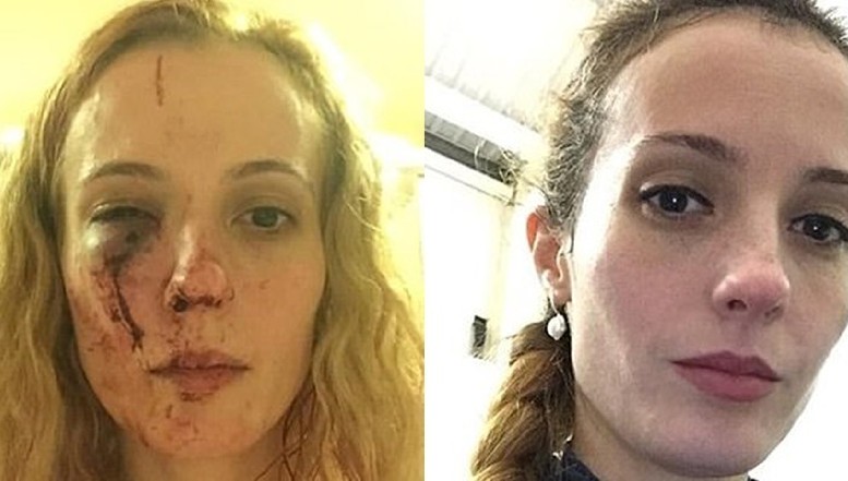 O româncă a fost atacată cu brutalitate în Marea Britanie de un grup de tineri care au crezut că e poloneză. Aceasta s-a lovit de ignoranța Poliției britanice