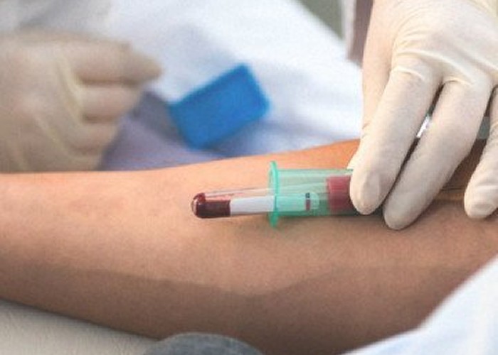 Constatare terifiantă a medicilor din SUA: coronavirusul determină îngroșarea și coagularea sângelui, provocând distrugerea organelor vitale