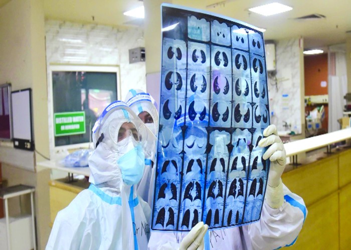 Medicul-șef de la Terapie Intensivă a izbucnit în plâns în timpul unui interviu: „Varianta asta (Delta) devorează pur și simplu plămânii pacienților” / „Ne mor prietenii, colegii, nu mai suportăm să vedem atâta moarte”