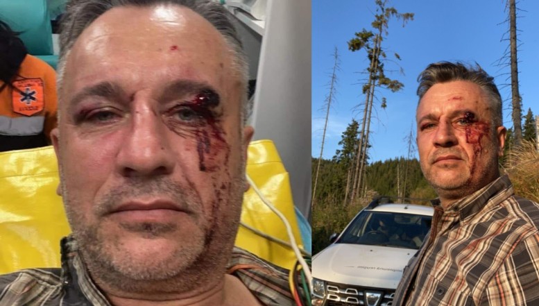 VIDEO. Așa arată lupta cu mafia lemnului protejată de autorități. Activistul Tiberiu Boșutar, bătut crunt și dezbrăcat în pielea goală într-o pădure din Suceava: „Nu e vorba de un caz izolat. E vorba de un sistem care ne pune piciorul pe cap” / El a părăsit spitalul la care fusese dus de urgență după ce un „angajat al statului” l-a sunat și l-a amenințat pentru că filmase în salvare