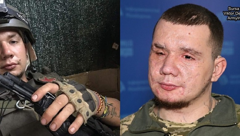 EXCLUSIV "I-am întrebat pe doctori dacă mai am ochi" / Povestea soldatului ucrainean Vladislav Ieșcenko, care și-a pierdut vederea în timpul activităților de deminare / Cum s-a recuperat și adaptat (Anna Neplii)